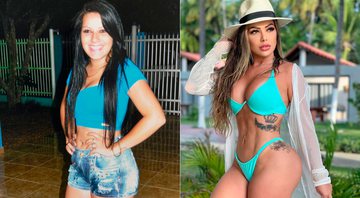 Jéssica Juliane antes e depois de gastar R$ 300 mil em 12 cirurgias plásticas - Foto: Arquivo pessoal
