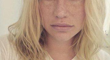 Kesha quer incentivar as pessoas a buscarem ajuda para tratar distúrbios alimentares - Foto: Reprodução/ Instagram