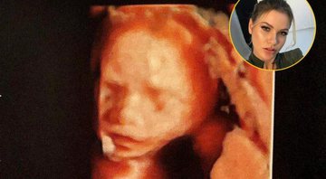 Andressa Suita mostrou o rostinho de Samuel, seu segundo filho, em ultrassom - Foto: Reprodução/ Instagram